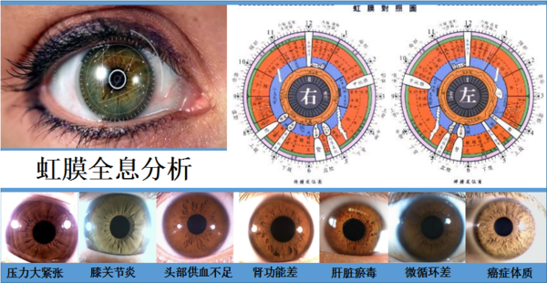 通过双眼虹膜,可以直观看到人体脏腑功能强弱,体质状态,体内毒素分布